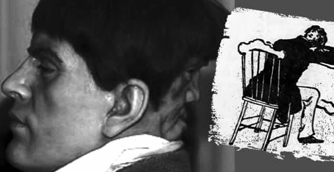 edward-mordrake-la-ai-giai-ma-bi-an-quai-nhan-hai-mat-hon-10_800